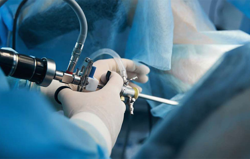 Arthroskopische Eingriffe am Ellenbogen in München - Prof. Dr. med. Martetschläger Arthroskopische Eingriffe am Ellenbogen in München - Durchgeführt von Prof. Dr. med. Martetschläger