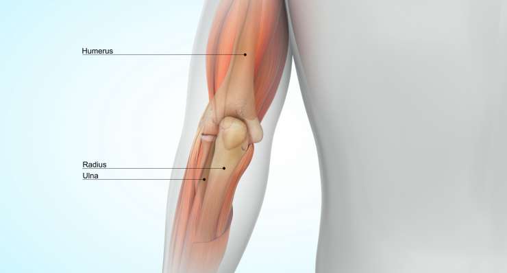 Ellenbogeninstabilität - Folge von Band- oder Kapselverletzungen. Behandlung in München durch Prof. Dr. med. Martetschläger
