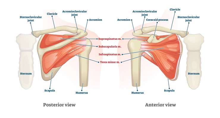 SC-Gelenk Luxation - Verrenkung des Brustbein-Schlüsselbeingelenks. Behandlung in München durch Prof. Dr. med. Martetschläger